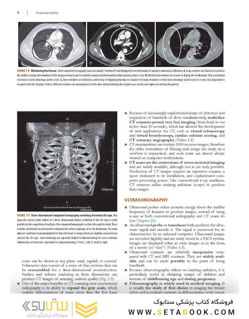 Learning Radiology: Recognizing the Basics