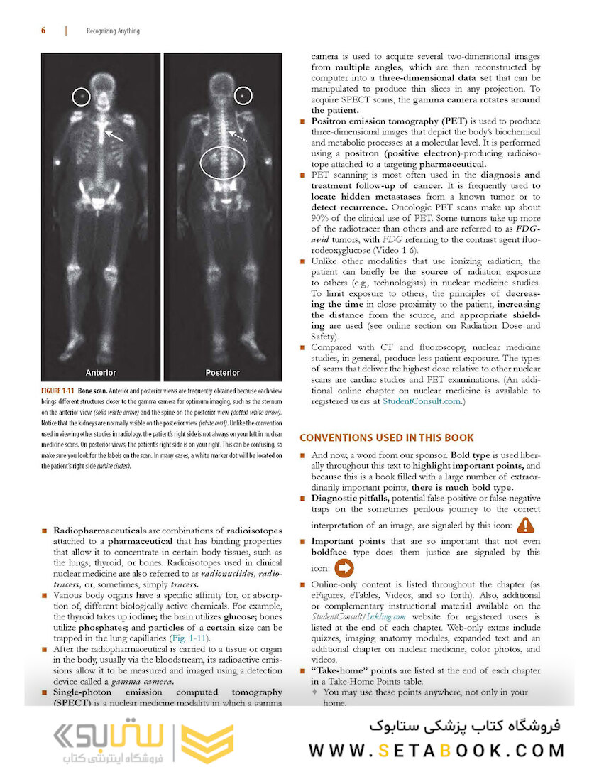Learning Radiology: Recognizing the Basics