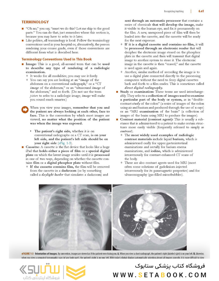 Learning Radiology: Recognizing the Basics