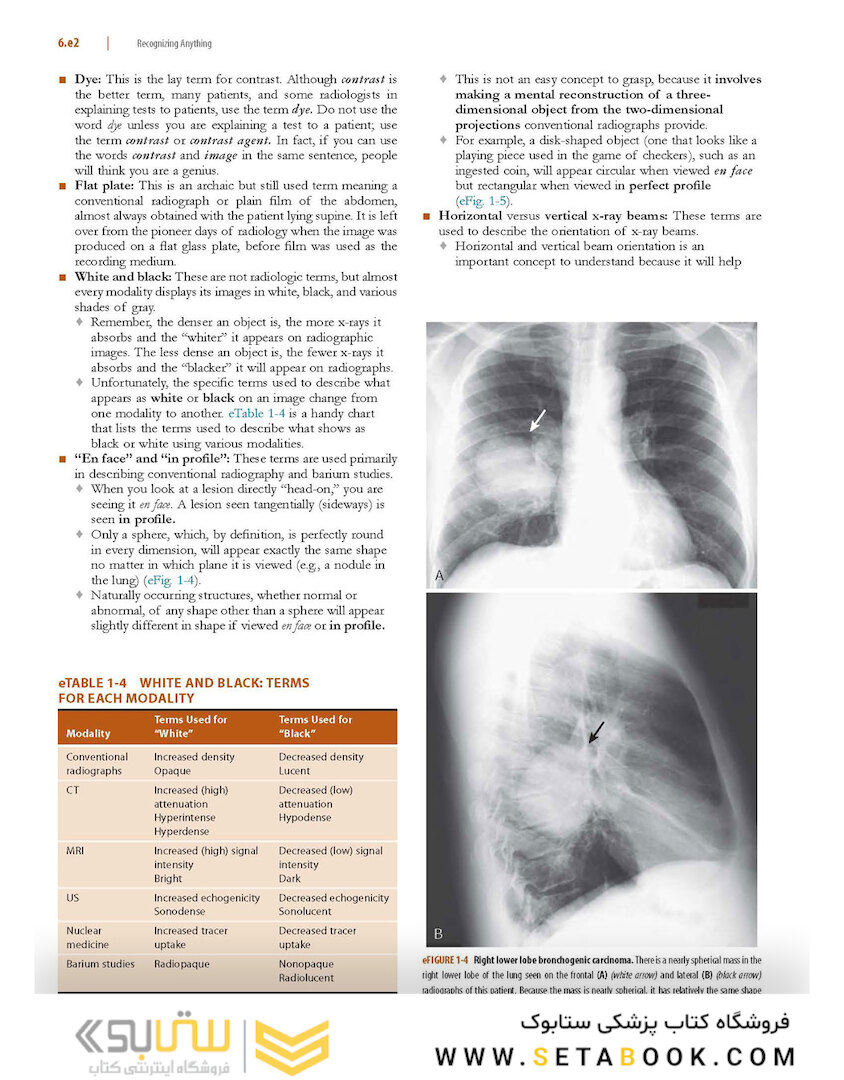Learning Radiology: Recognizing the Basics