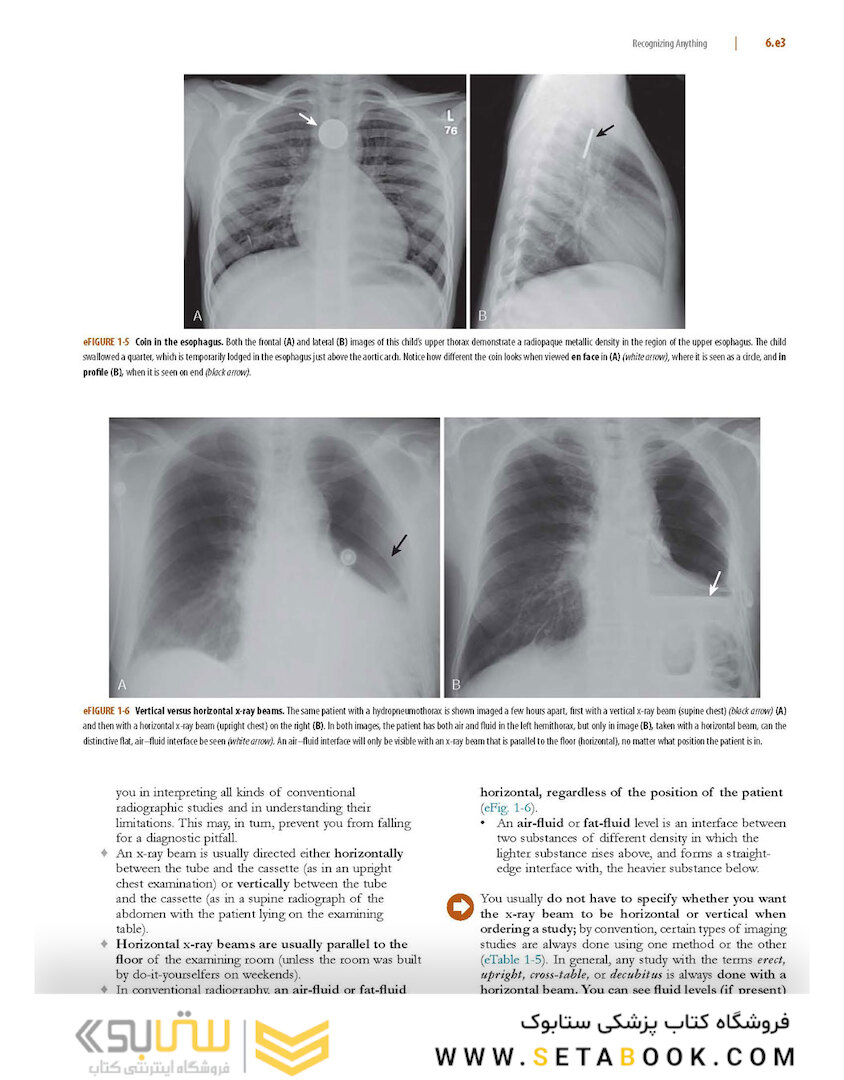 Learning Radiology: Recognizing the Basics