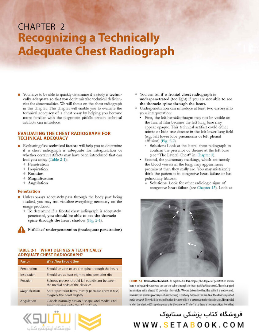 Learning Radiology: Recognizing the Basics
