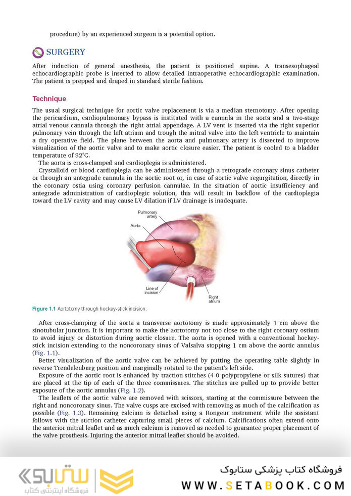 Cardiac Surgery (Master Techniques in Surgery)