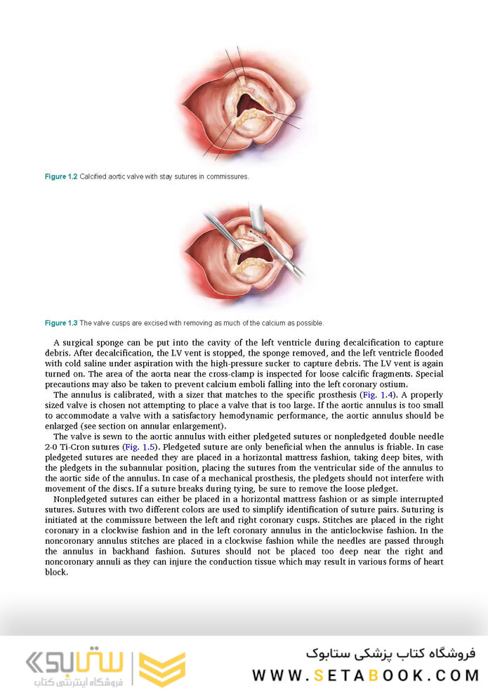Cardiac Surgery (Master Techniques in Surgery)