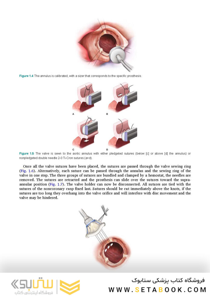 Cardiac Surgery (Master Techniques in Surgery)