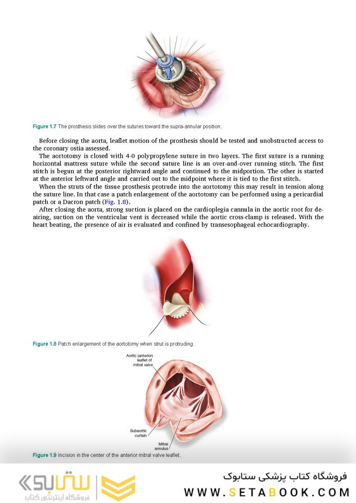 Cardiac Surgery (Master Techniques in Surgery)
