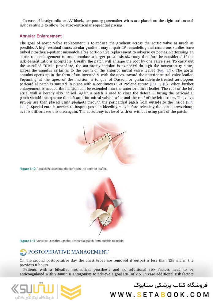 Cardiac Surgery (Master Techniques in Surgery)
