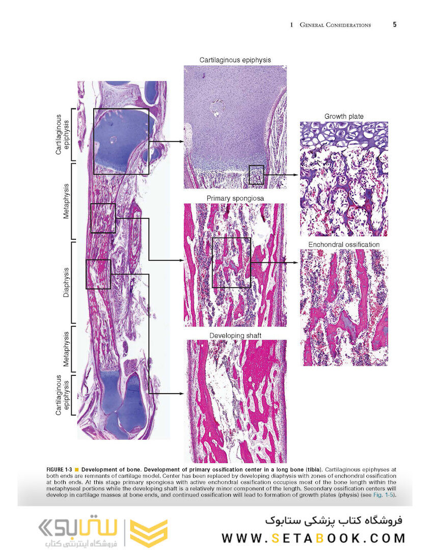 Dorfman and Czerniak