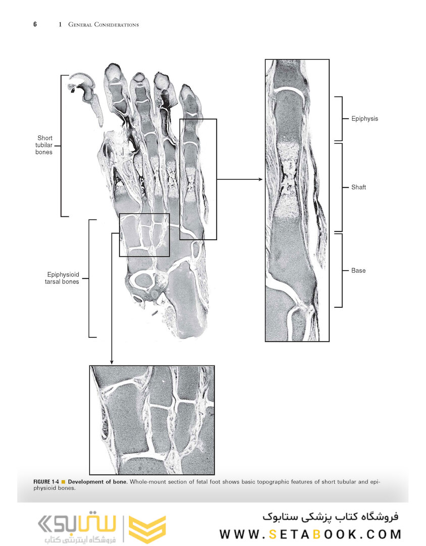 Dorfman and Czerniak