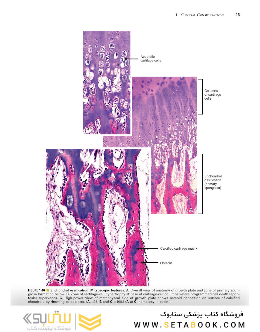 Dorfman and Czerniak