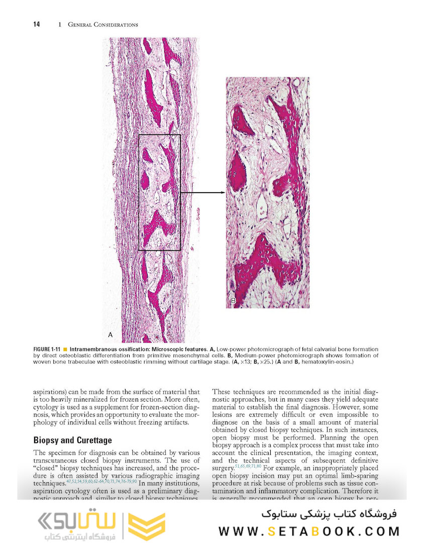Dorfman and Czerniak