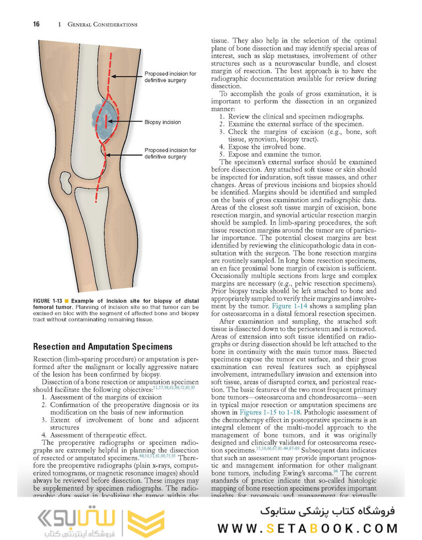 Dorfman and Czerniak