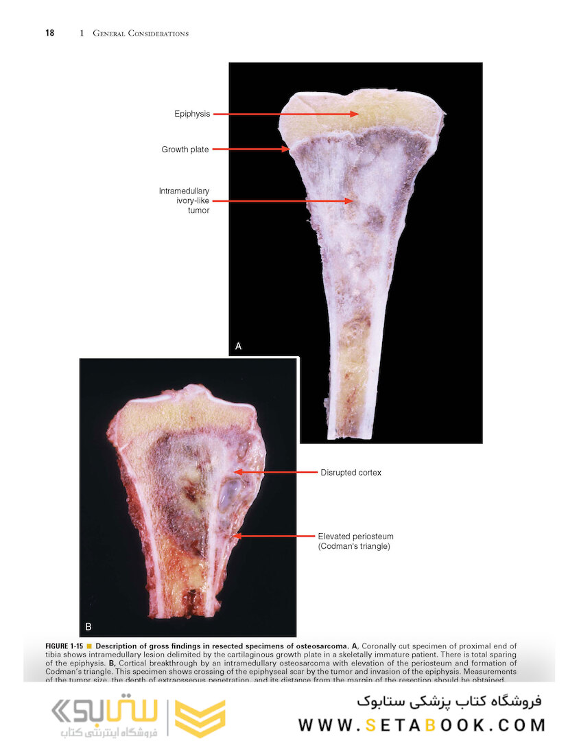 Dorfman and Czerniak