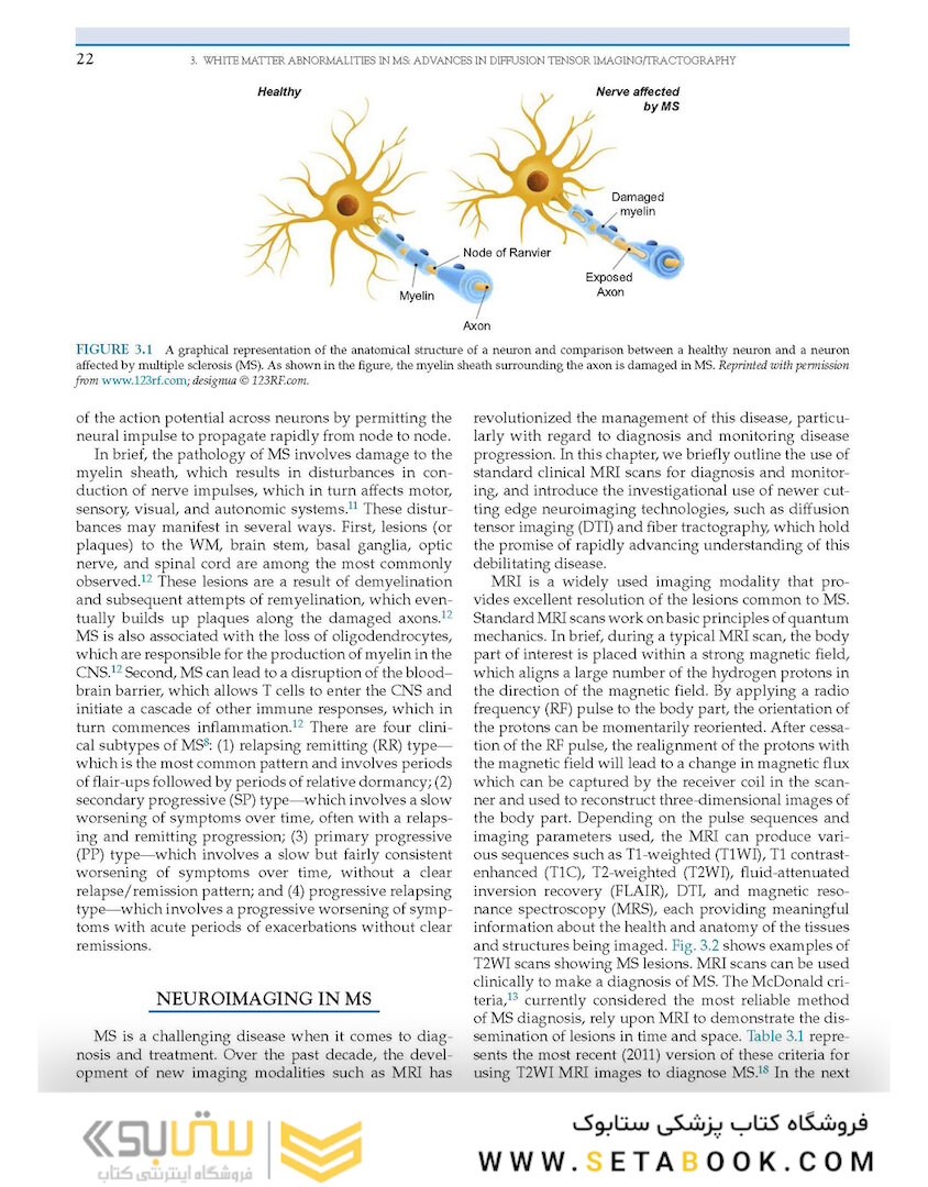 Nutrition and Lifestyle in Neurological Autoimmune Diseases : Multiple Sclerosis