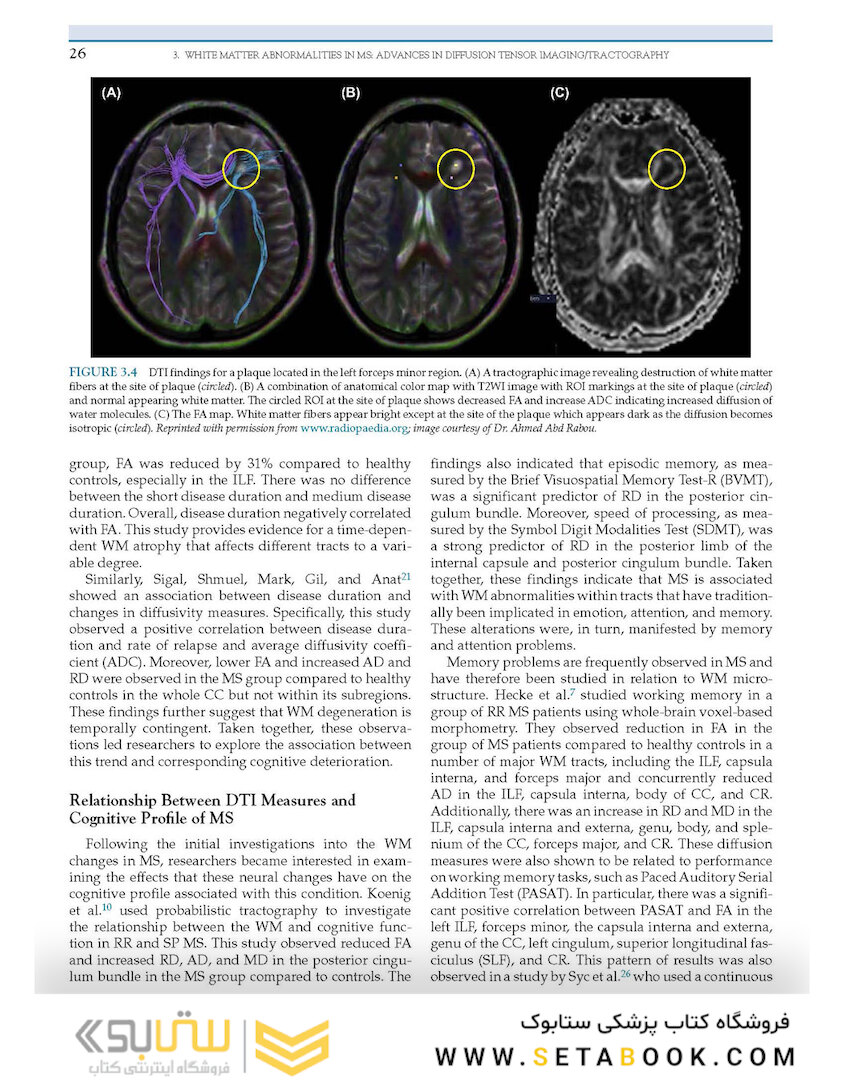 Nutrition and Lifestyle in Neurological Autoimmune Diseases : Multiple Sclerosis