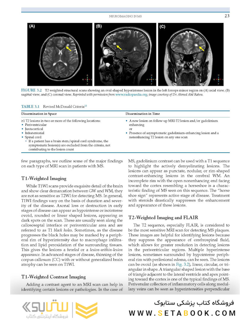 Nutrition and Lifestyle in Neurological Autoimmune Diseases : Multiple Sclerosis