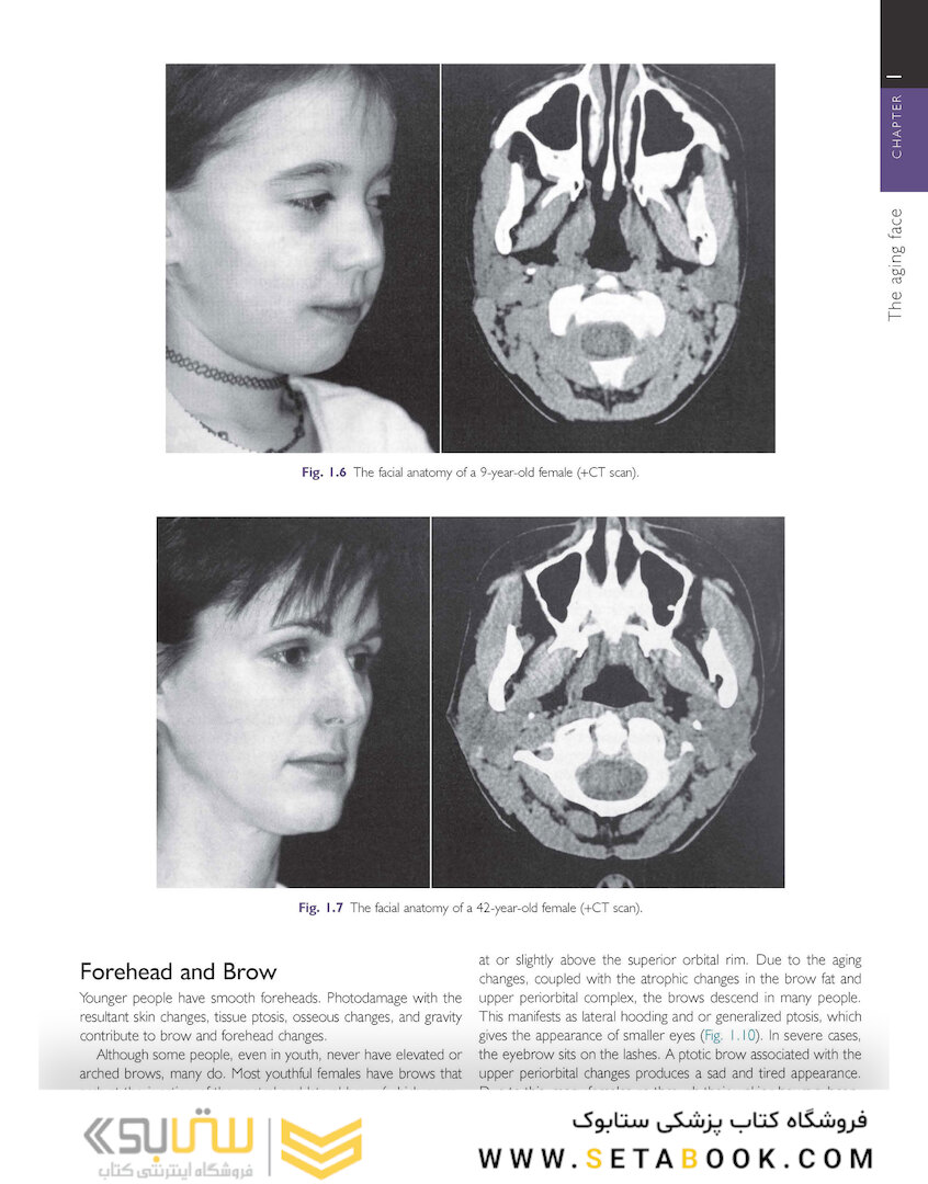 Cosmetic Facial Surgery 2nd Edicion