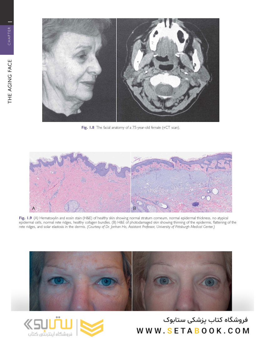 Cosmetic Facial Surgery 2nd Edicion