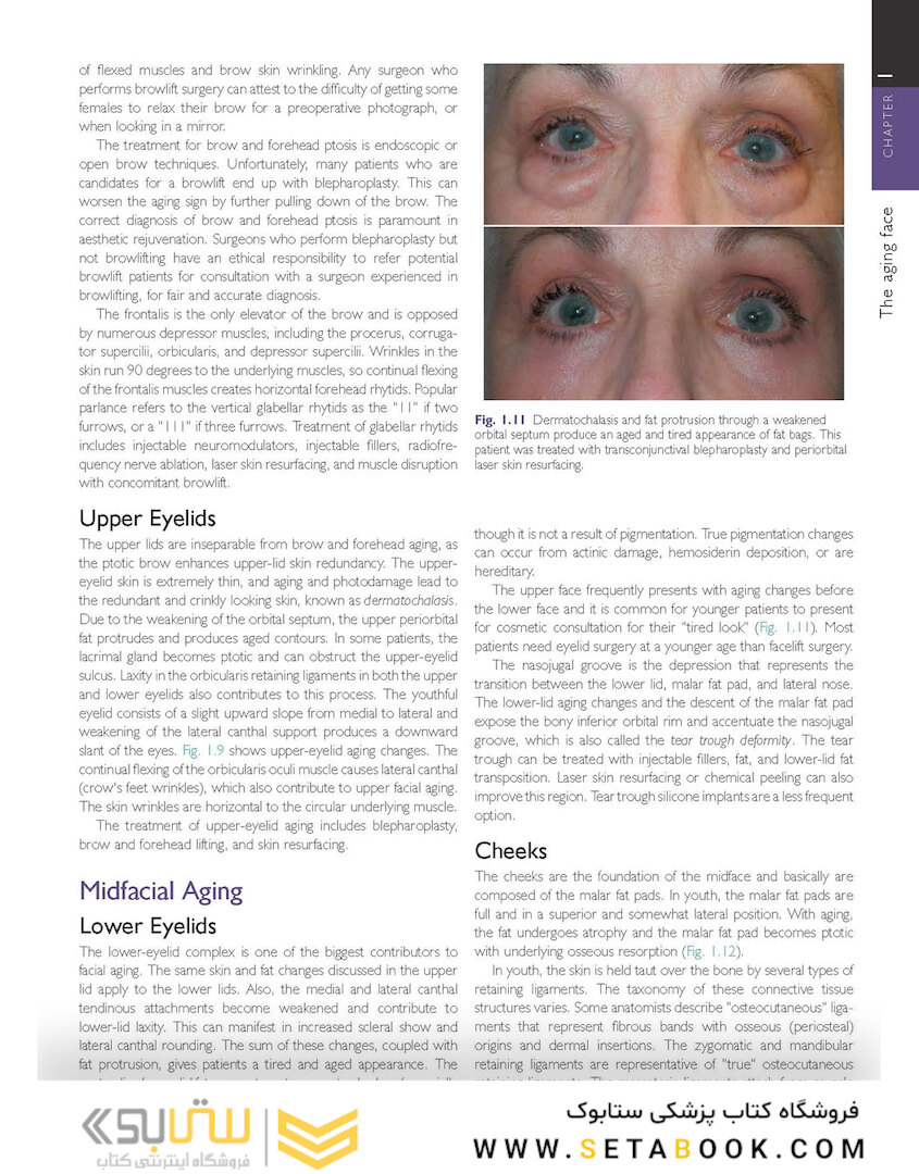 Cosmetic Facial Surgery 2nd Edicion