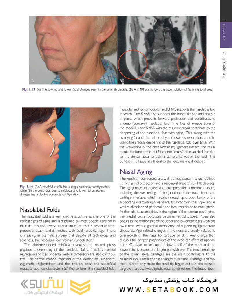 Cosmetic Facial Surgery 2nd Edicion