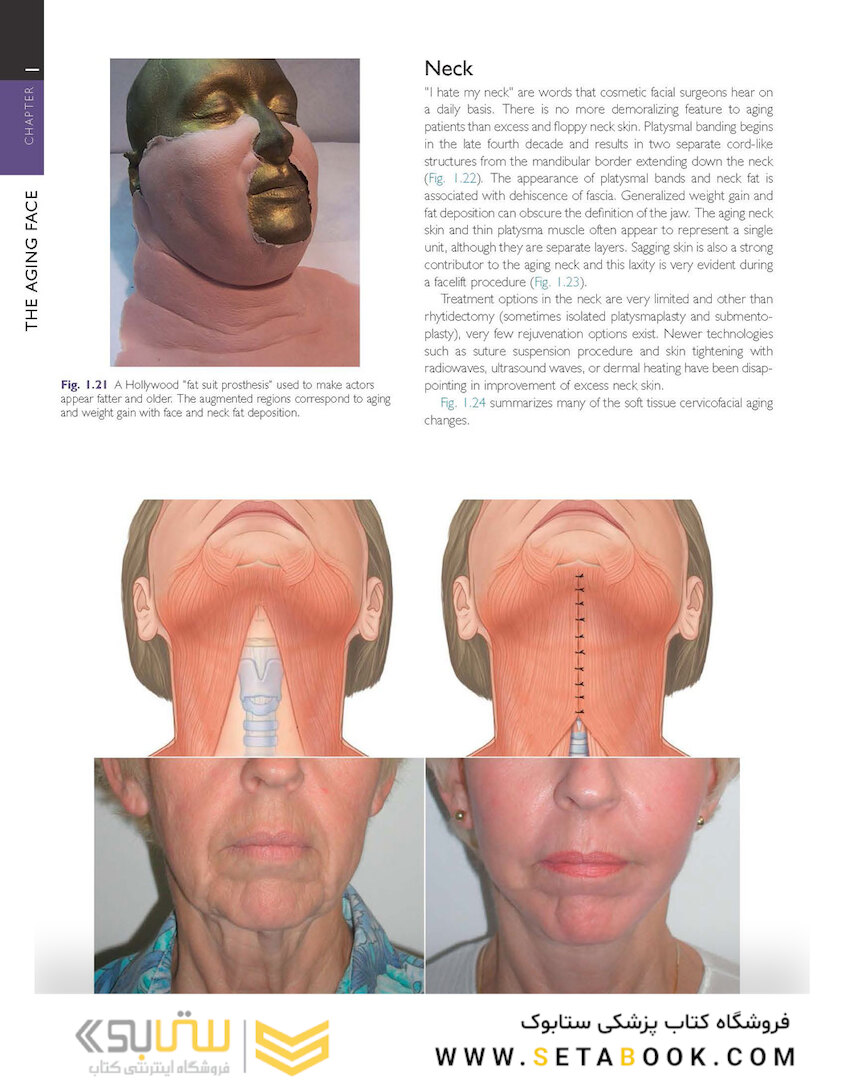 Cosmetic Facial Surgery 2nd Edicion