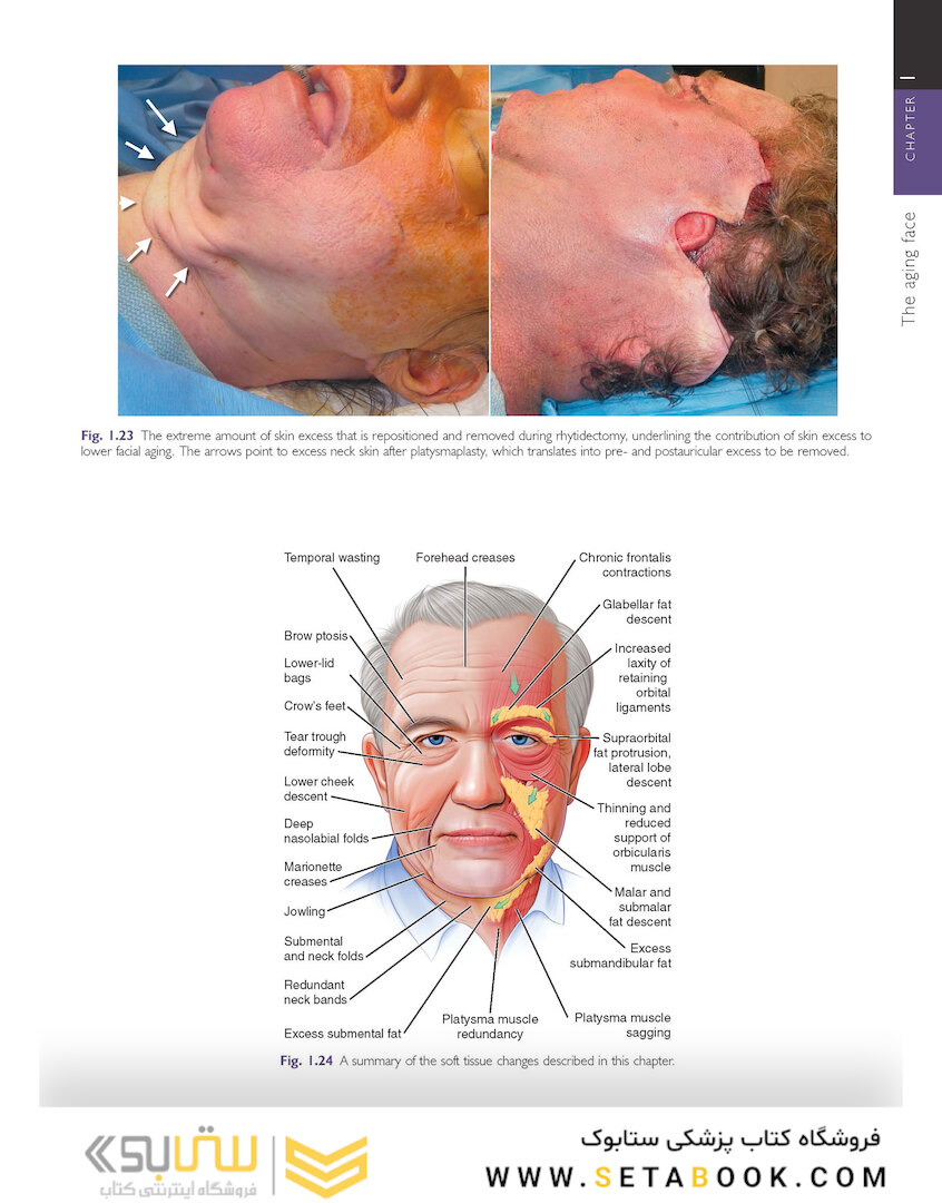Cosmetic Facial Surgery 2nd Edicion