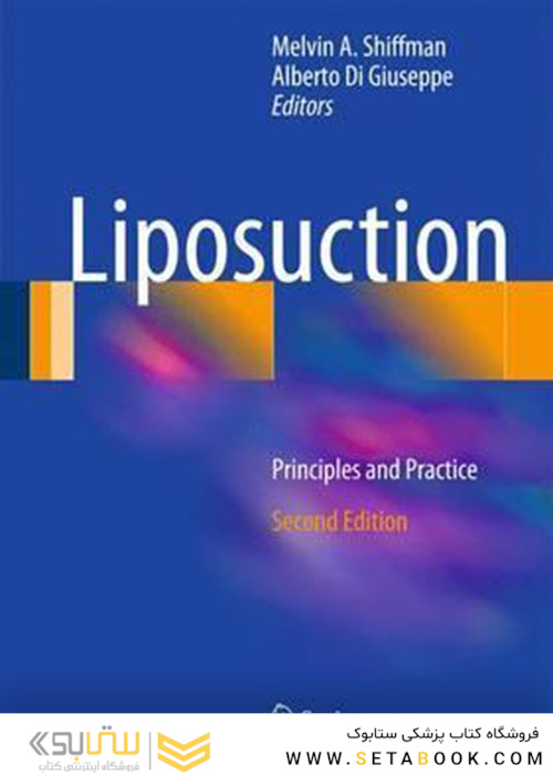 Liposuction : Principles and Practice