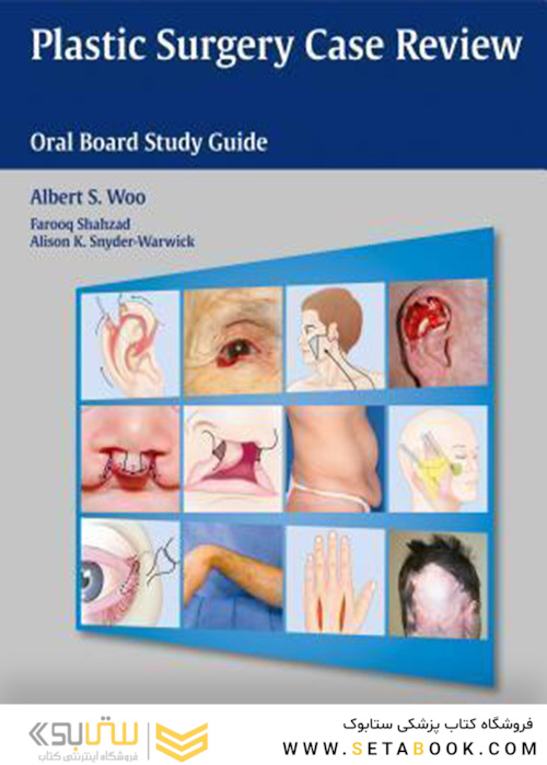 Plastic Surgery Case Review : Oral Board Study Guide