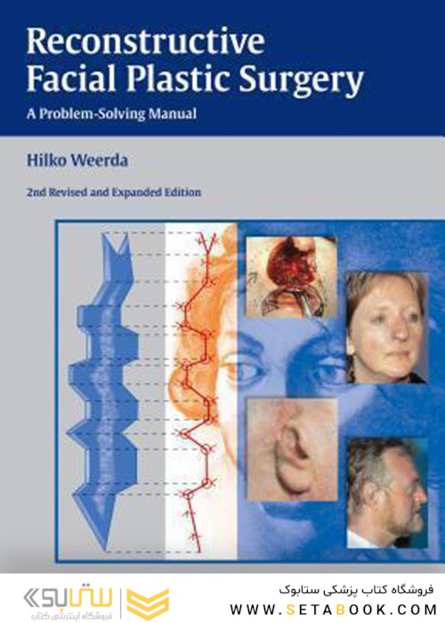 Reconstructive Facial Plastic Surgery : A Problem-Solving Manual