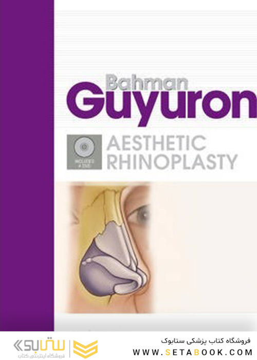Rhinoplasty