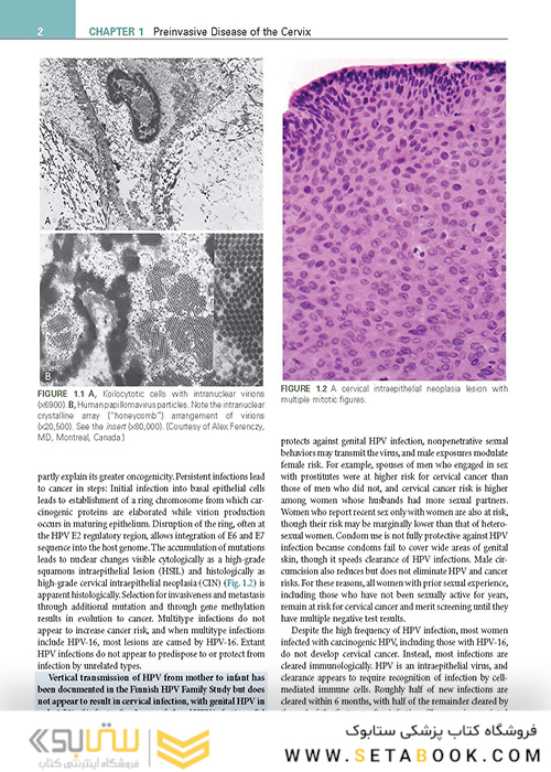Clinical Gynecologic Oncology