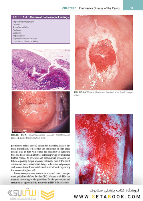 Clinical Gynecologic Oncology