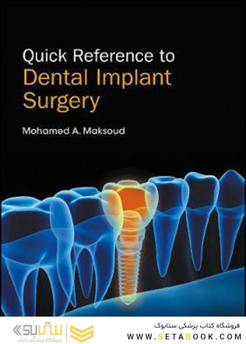 Quick Reference to Dental Implant Surgery