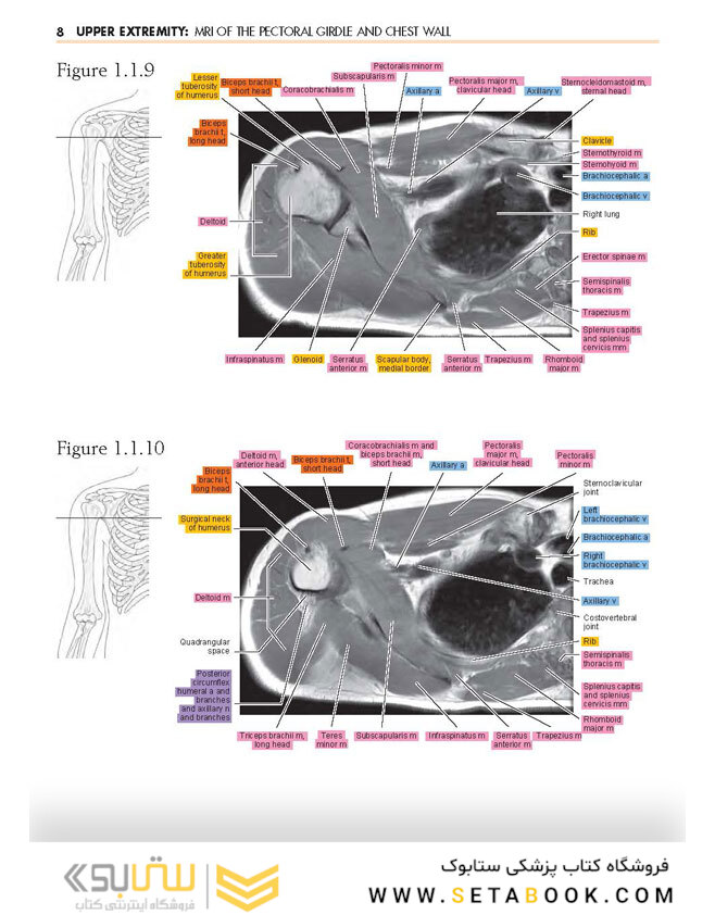 Sectional Anatomy by MRI and CT