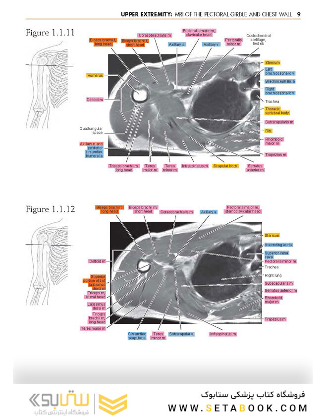 Sectional Anatomy by MRI and CT