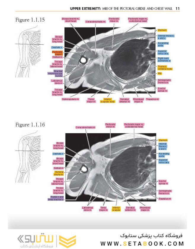 Sectional Anatomy by MRI and CT