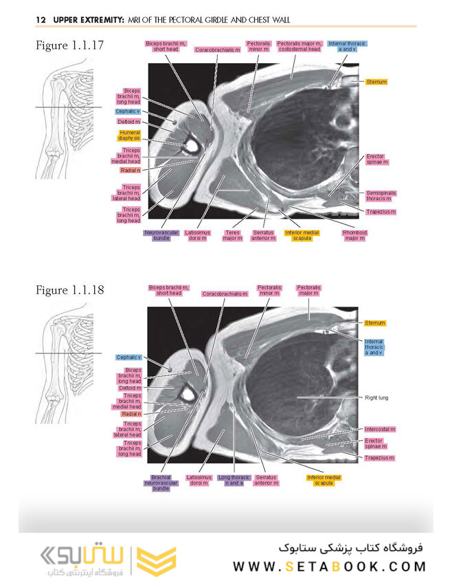 Sectional Anatomy by MRI and CT