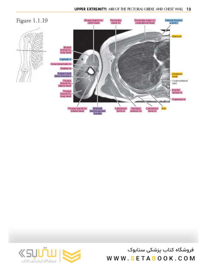 Sectional Anatomy by MRI and CT