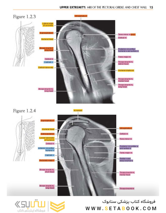 Sectional Anatomy by MRI and CT