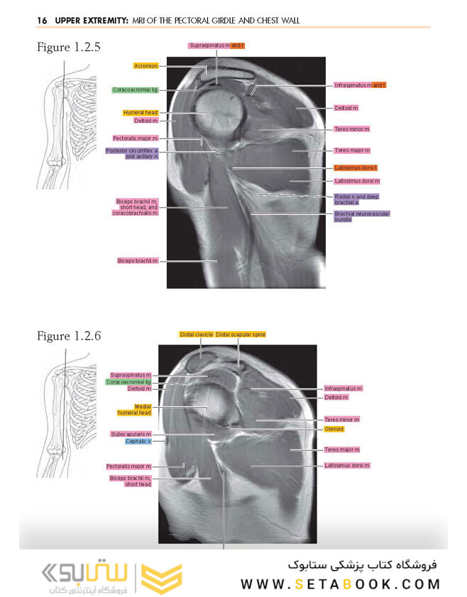 Sectional Anatomy by MRI and CT