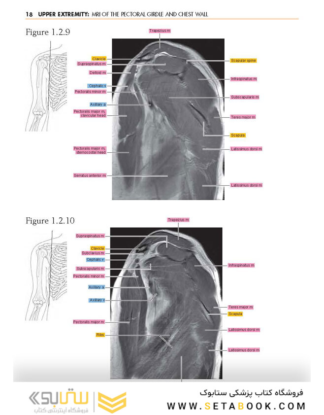 Sectional Anatomy by MRI and CT