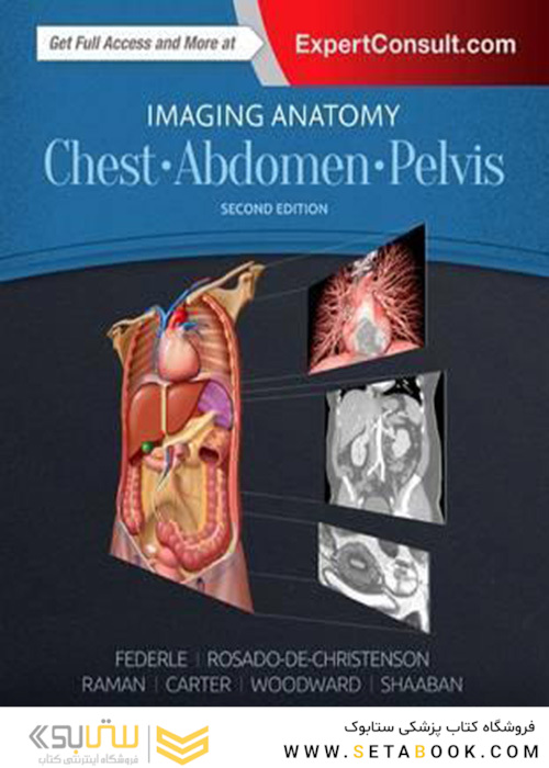 Imaging Anatomy: Chest, Abdomen, Pelvis