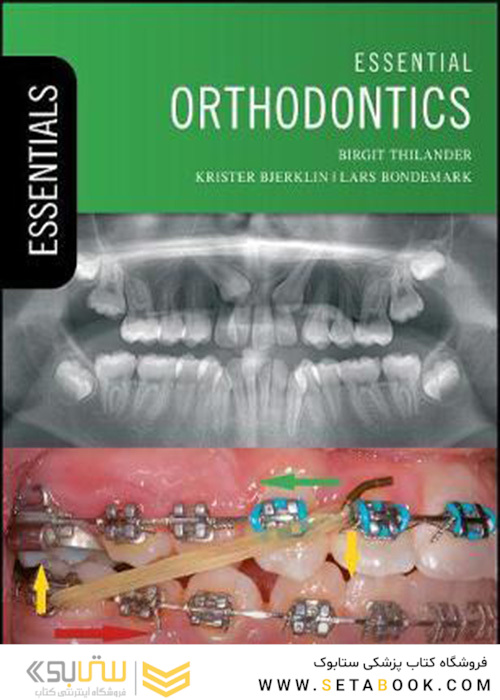 Essential Orthodontics