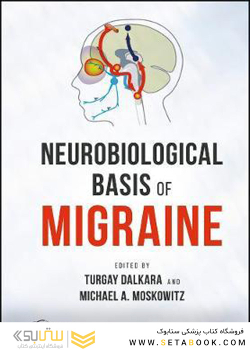 Neurobiological Basis of Migraine