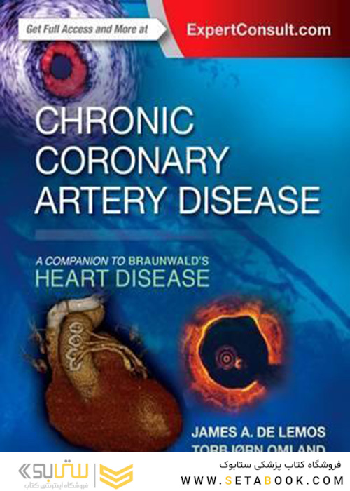 Chronic Coronary Artery Disease : A Companion to Braunwald