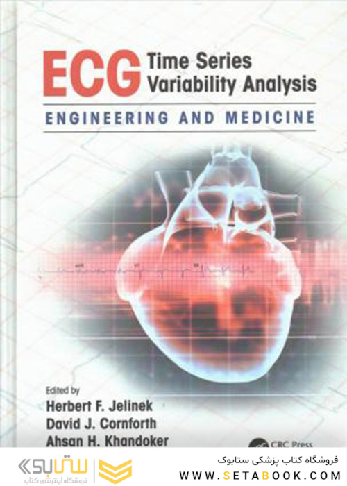 ECG Time Series Variability Analysis