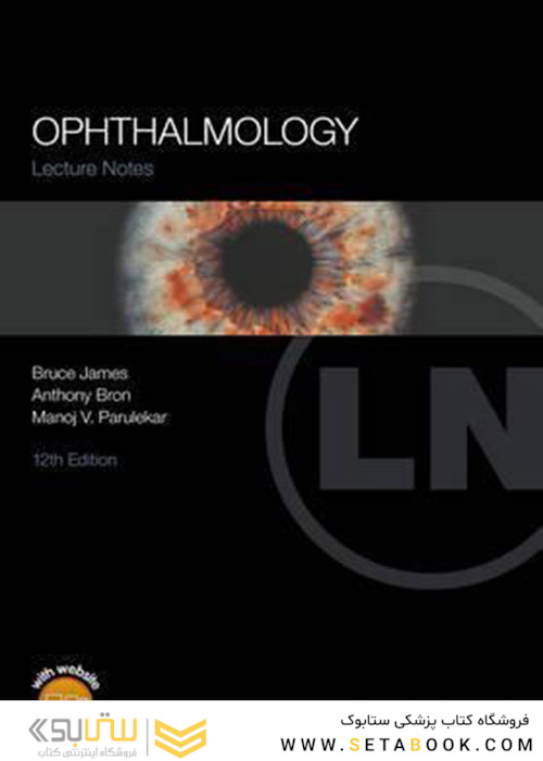 Lecture Notes Ophthalmology