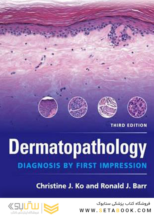 Dermatopathology : Diagnosis by First Impression