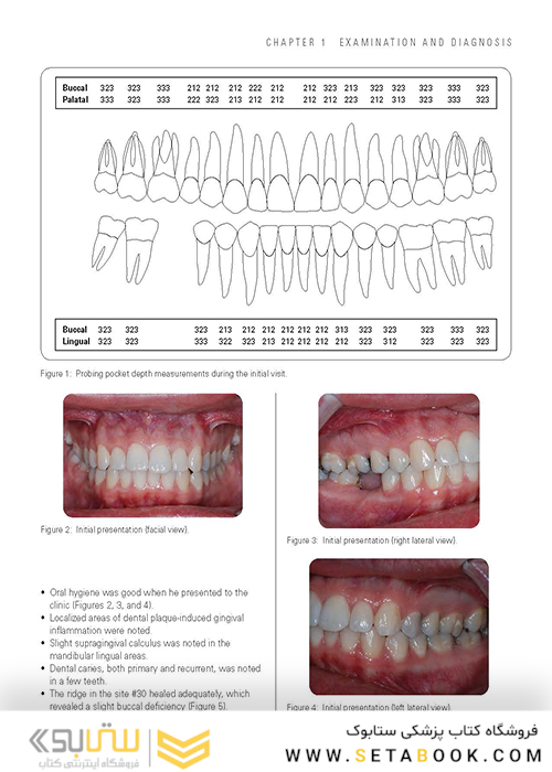 Clinical Cases in Implant Dentistry