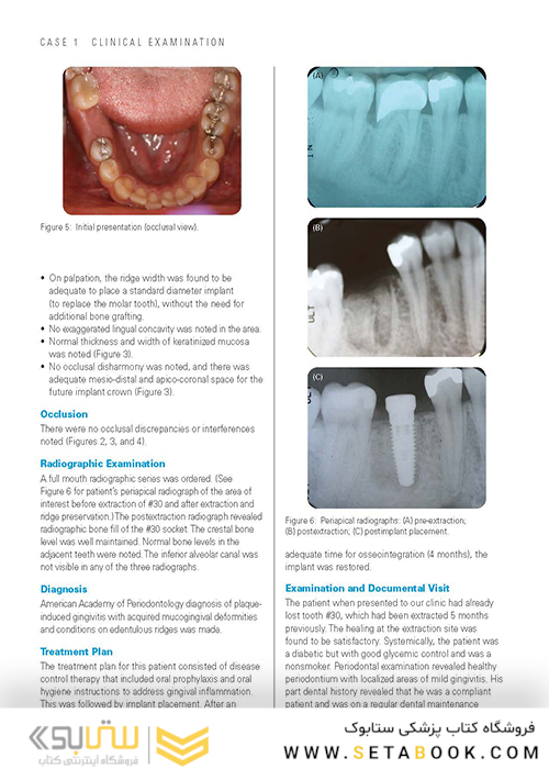 Clinical Cases in Implant Dentistry